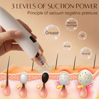 Blackhead Remover Pro