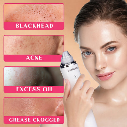 Blackhead Remover Pro